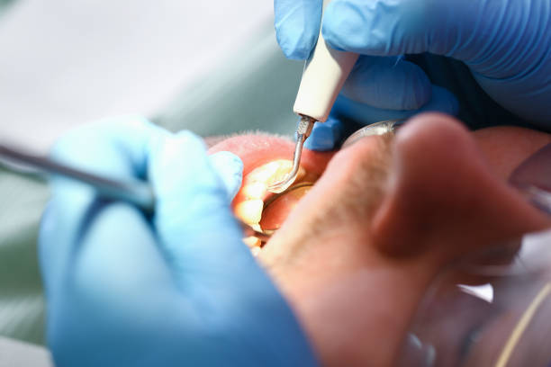 Best Emergency Treatment for Jaw Pain or Injury in Big Bass Lake, PA