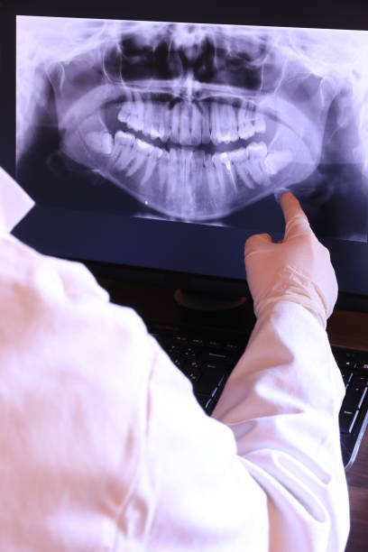 Best Emergency Wisdom Tooth Extraction in Big Bass Lake, PA
